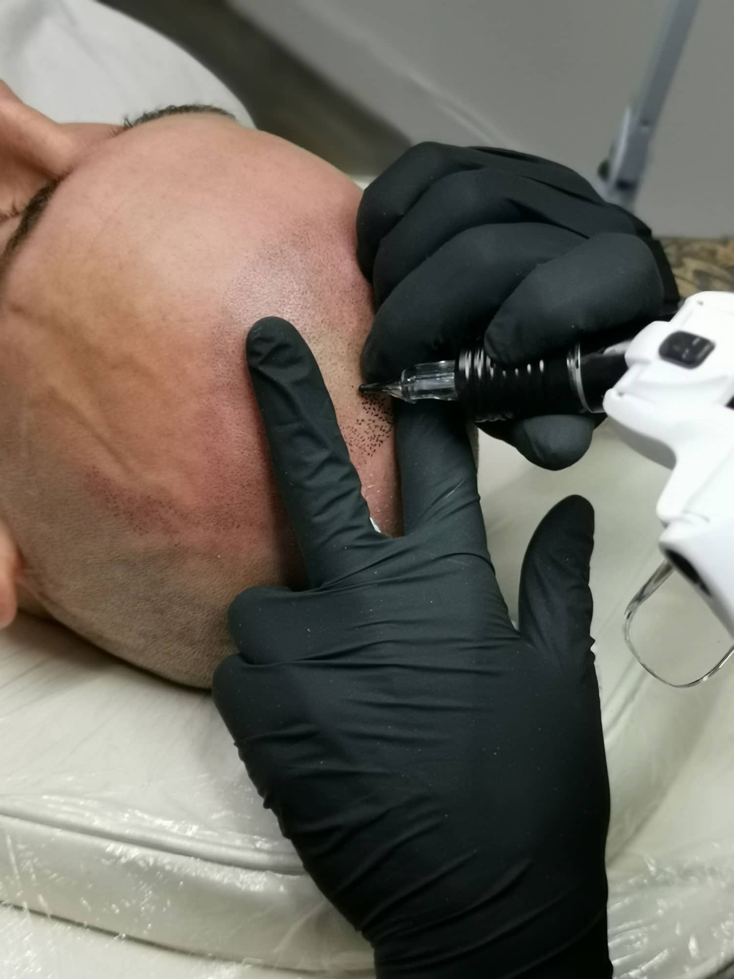 What is the recovery time for SMP?